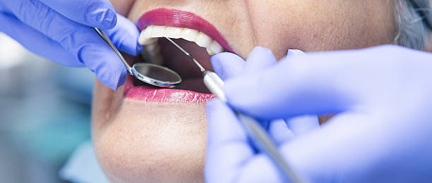 Best Emergency Dental Extractions in Mendota, CA